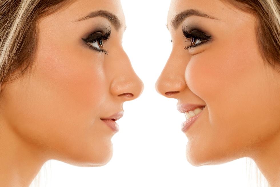 Soins avant et après rhinoplastie