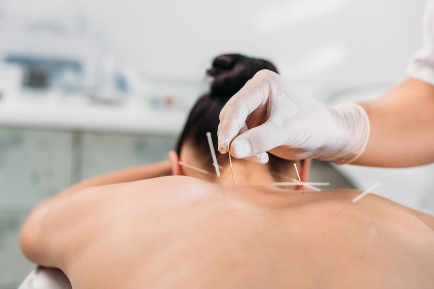 Quels sont les avantages de l’acupuncture pour la santé du sommeil ?